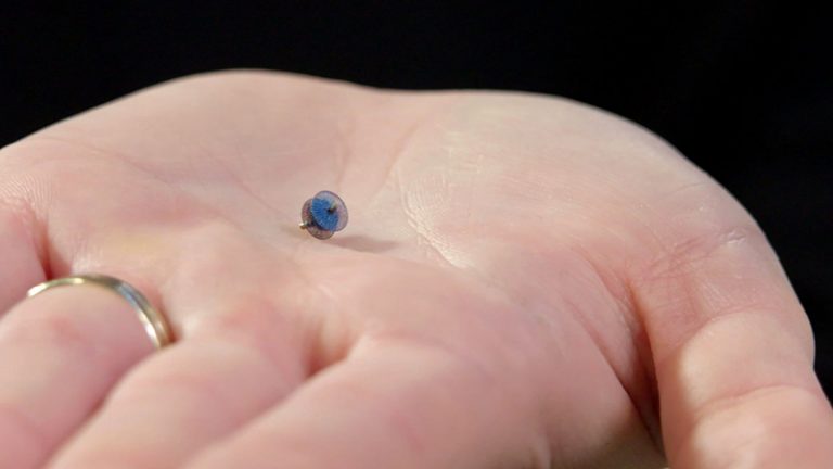 PDA’lı bebekler için yeni tedavi: Occluder