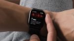 Apple Watch EKG özelliği Avrupa’ya açıldı!
