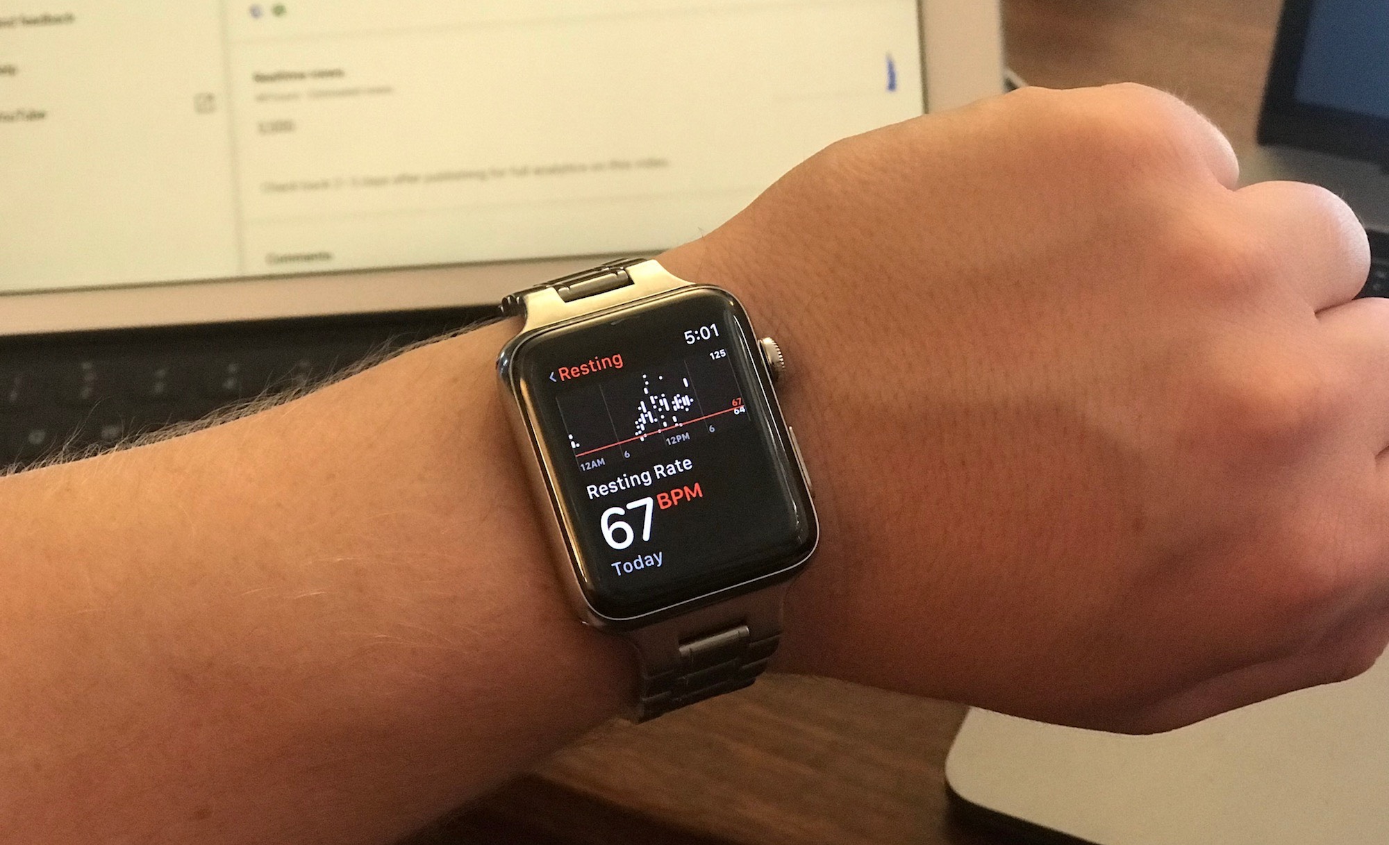 Apple Watch taşikardiyi erkenden tespit etti!