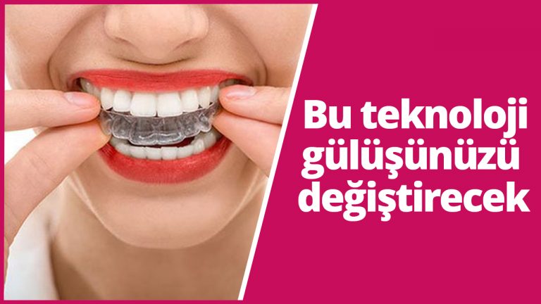 Bu teknoloji gülüşünüzü değiştirecek!