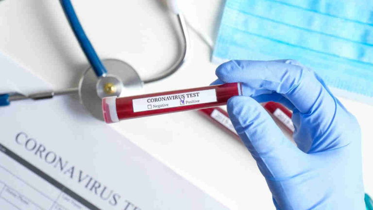 Amerika’daki Türk şirketinden evde Corona testi