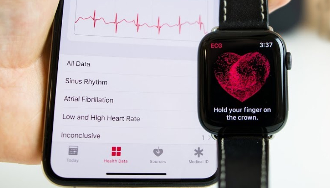 Apple Watch EKG Türkiye