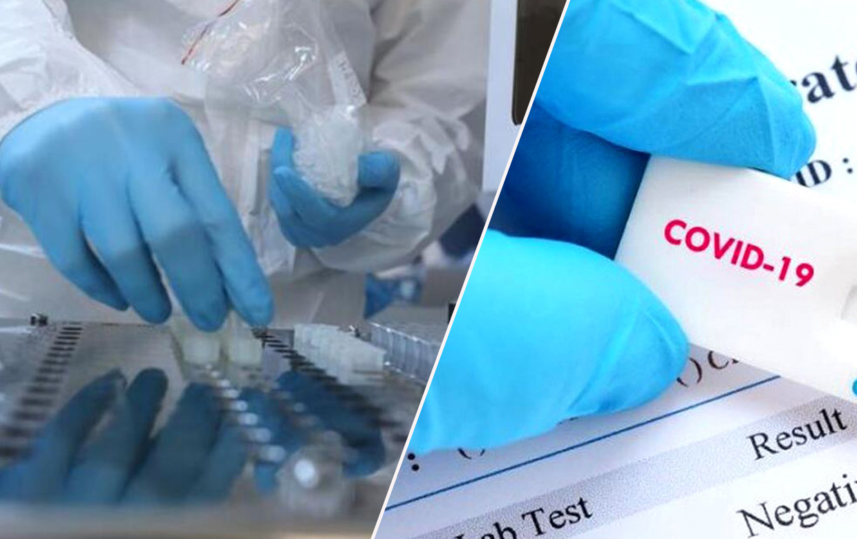 koronavirüs testi, yeni koronavirüs testi, koronavirüs