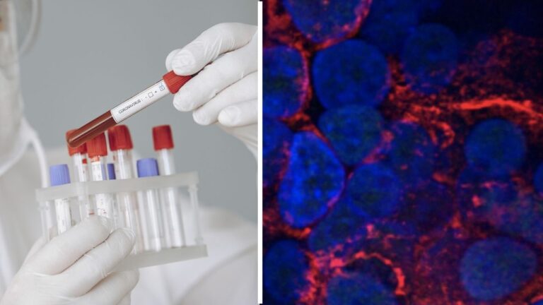 Koronavirüsün bulaştığı akciğerlere neler oluyor?