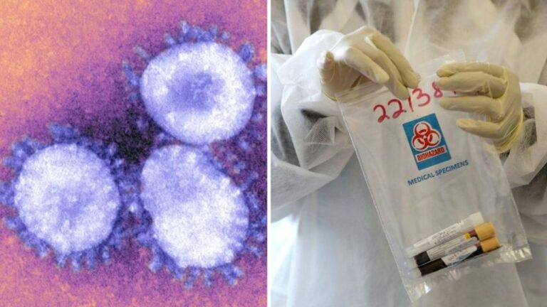 Mutasyonlu virüs için Oxford Üniversitesi açıklaması