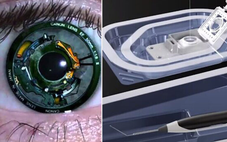 On yıldır kör olan adam yapay kornea ile gördü