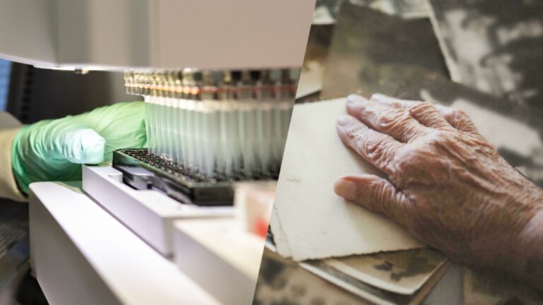 Yeni Alzheimer ilacı bilim insanlarını ikiye böldü