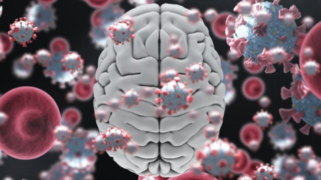 COVID-19 beyinde gri madde hasarına yol açıyor