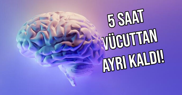 Bilim insanları, beyni vücuttan ayrı çalıştırabilmeyi başardı!