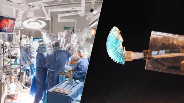 robotik kalp ameliyatı, robotik karter, robotik ameliyat