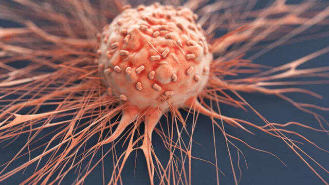Bilim adamları laboratuvarda kanser hücrelerinin %99'unu yok ediyor!