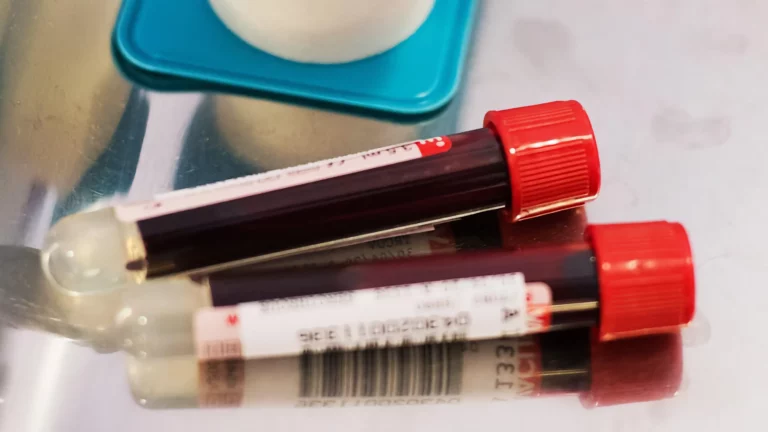 BilliontoOne yatırımı 48.5 milyon dolara ulaştı