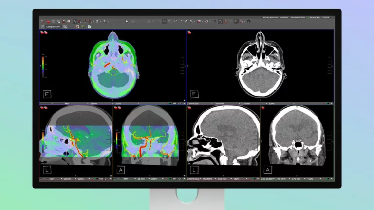 Apple Hastane İşine de El Attı