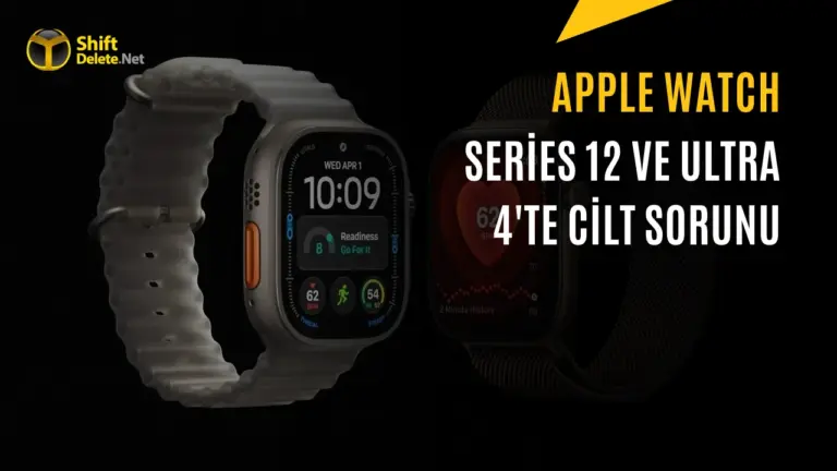 Apple Watch Kullanıcıları Tedirgin: Cilt Tahrişine Neden Oluyor — Apple Watch cilt tahrişi, Apple Watch kordonu alerji yapar mı, akıllı saat bilek kızarıklığı, Apple Watch temizliği nasıl yapılır, akıllı saatlerde cilt hassasiyeti